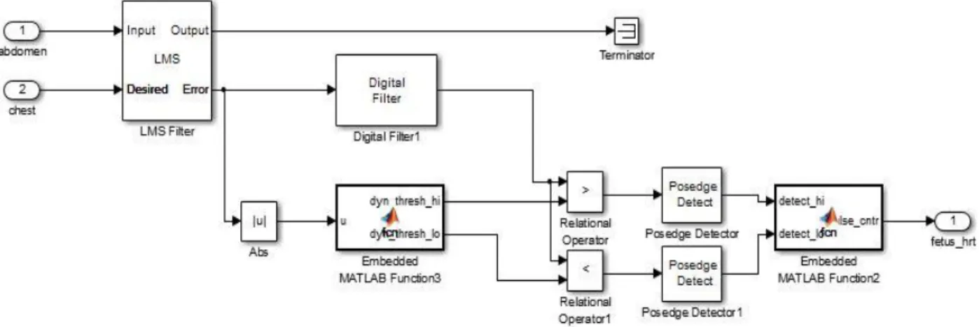Fig 2.3 Simulink Model 2  2.4 LEAST MEAN SQUARE (LMS) ALGORITHM 