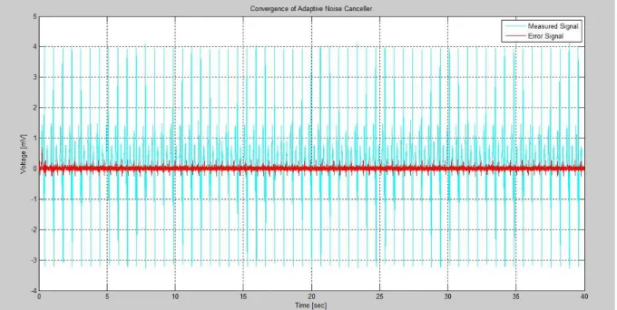 Fig 2.9 Output of the Adaptive Noise Canceller (ANC) 