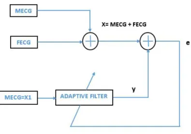 Figure 2.3: ANC Block Diagram