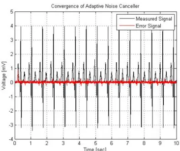 Figure 4.3: Output of the Adaptive Noise Canceller (ANC)