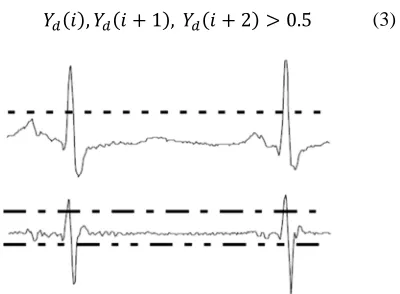 Fig. 3: Processed ECG signal. (a) ECG signal and detection threshold (dashed line). (b) First derivative, positive threshold (dash dot line), and negative threshold (dash double dot line)