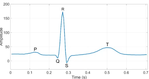 Fig. 5. Example of a heartbeat wave in an ECG signal, with the fiducial points used for recognition