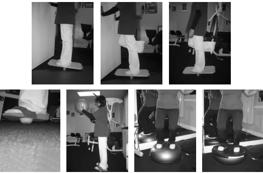 Figure 4Progression of balance training. The patient is put on a rocker board while holding to the wall