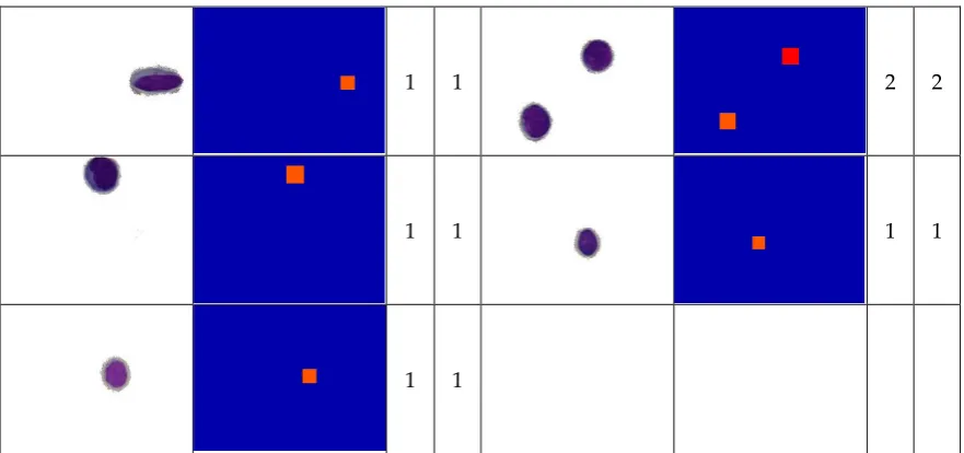 Table 5. The predicted (P) and actual count (A) of RBCs. 