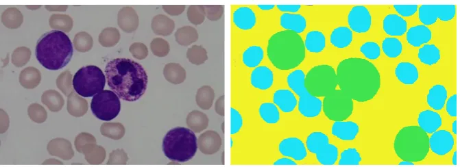 Figure 1. The shape of the five major types of white blood cells. 