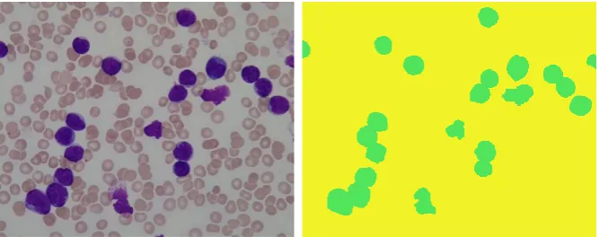 Figure 3. A peripheral blood smear image and its ground truth in dataset 2. 