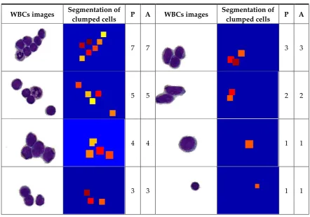Table 4. The predicted (P) and actual count (A) of WBCs. 