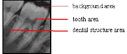 Fig. 1.  The tooth area has a high grayscale value, and it is the main part of the image