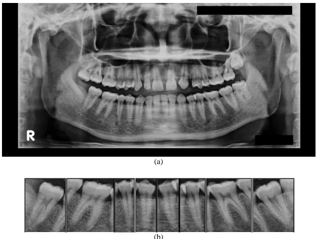 Fig. 3  Dental x-ray image segmentation process framework 