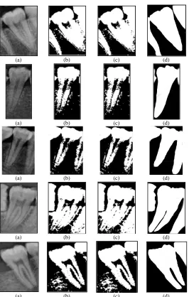Fig. 5  Comparison of segmentation result (a) original image; (b) segmentation results of csFCM; (c) segmentation results of csFCM-GK; (d) ground truth  