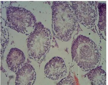 Fig. 5. Section of testes tissue in second Section of testes tissue in second group treated with (1000 mg/kg) of Zantac mg/kg) of Zantac 
