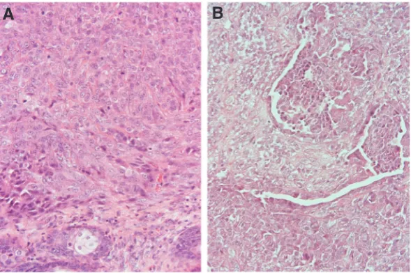 Fig. 2. Light micrographs of formed tumors from the CMT-U229 avl2 cells in nude mice. Simple carcinoma of solid type from CMT-U229 avl2 cells at passage 131 (A)