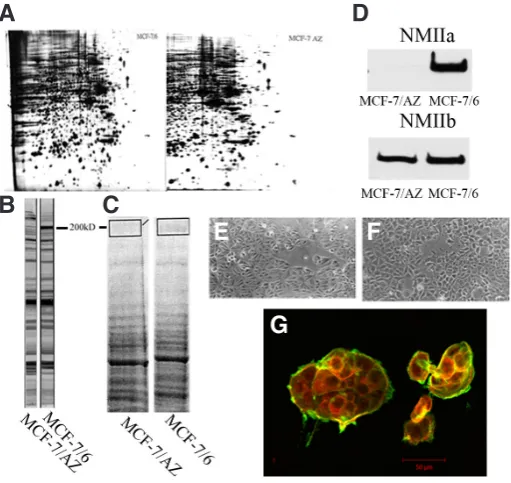 Fig. 1. Differential expression of non-muscle myosin IIA (NMIIA) in MCF-7/6 and MCF7/AZ cells