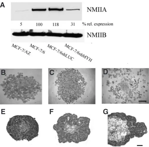 Fig. 2 (Top). Silencing of non-muscle myosin IIA (NMIIA) in MCF-7/6 