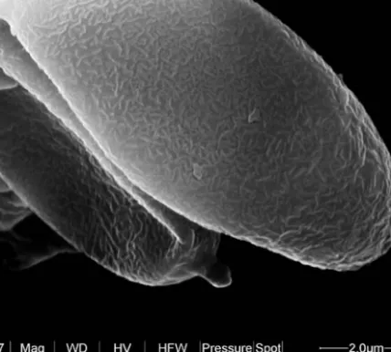Fig. 5. Spore of Phylloporus pelletieri (JŠ 3412) with bacillate surface ornamentation (x 25 000).
