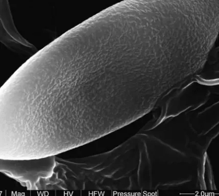 Fig. 1. Spore of Xerocomus subtomentosus (JŠ 4134) with bacillate surface ornamentation (x 24 000).
