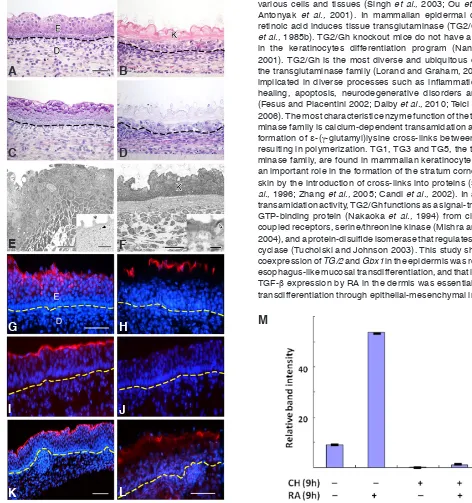 Fig. 1. Transdifferentiation of epidermis of retinoic acid �RA�-pretreated skin to esophagus-like mucosal epithelium