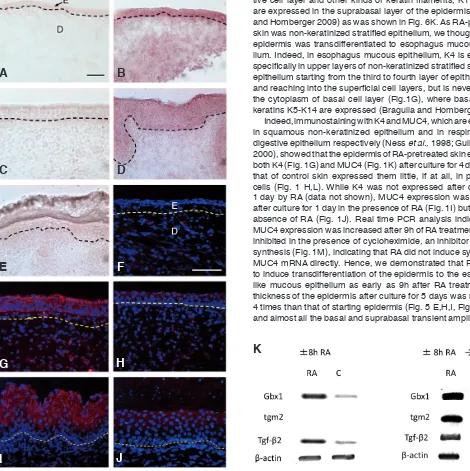Fig. 2. Increase in expression of mRNA and protein of TG2/Gh in the epidermis b� retinoic acid �RA�