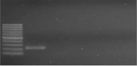 Fig. 4: Picture of the affected eye of case 1