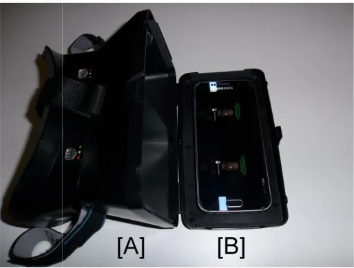 Figure 1. RITECH II headset headset [A] containing phone and displaying stereoscopic view of 