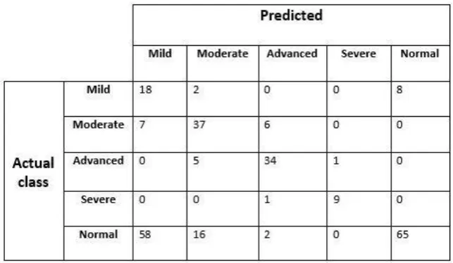 Table Ⅰ. Keratoconus detection accuracies and 100 times for normal eyes (right) 