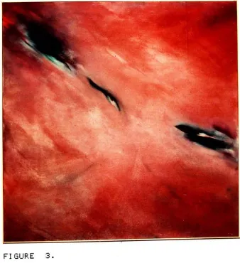 FIGURE3.18