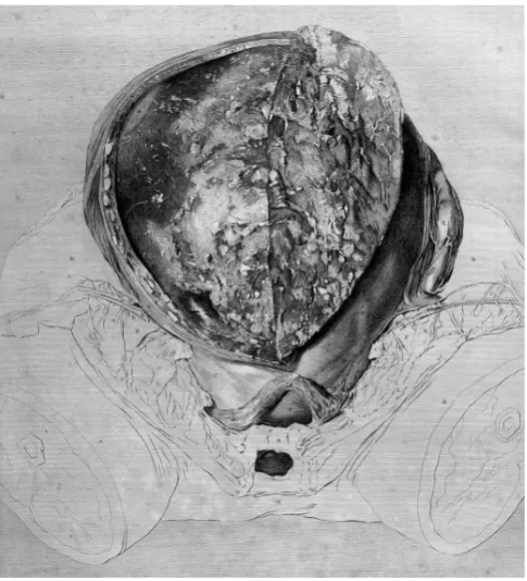 Fig. 6. The human placenta as depicted in William Hunter’s The