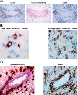 Fig. 2. Immunohistochemical demonstration  of cell populations in Representative photomicrographs of serial sec-and the complete absence of EVT