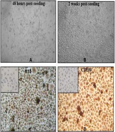 Fig. 3  Primary culture of human HFSCs (A,B). Magnification 100x.  Characterization of HFSCs using K15 (C) and CD200 (D)