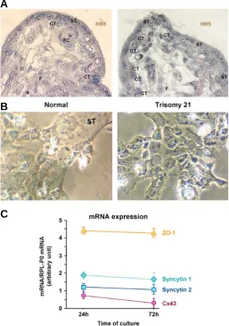 Fig. 3. Evolution of membrane protein expression during in vitrodifferentiation of trophoblastic cells isolated from trisomy 21-af-Scale bar = 10 tiotrophoblast (ST) increasing the thickness of the trophoblastic layer.cuboidal cytotrophoblastic cells (CT) 