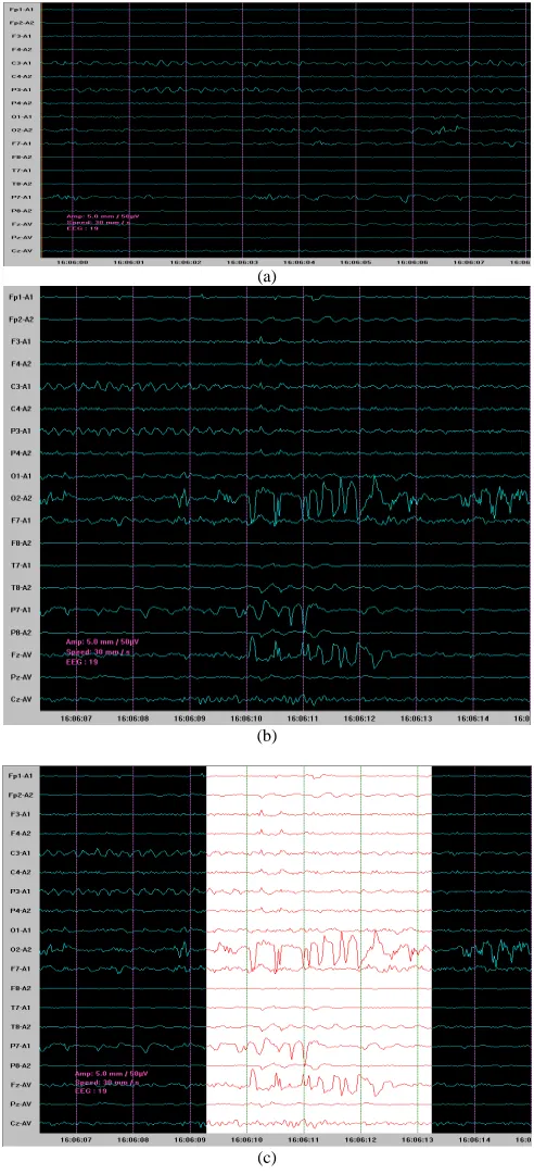 Fig. 8  Cameras [23]  
