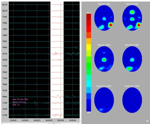 Fig. 13  Wave of emotions surprised 
