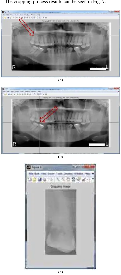 Fig. 7. The process of image acquisition (a) initial coordinate point is at upper left (upper right of the patient position /[R]ight), (b) initial coordinate point is at lower left (Under right of the patient position/[L]eft), (c) image cropping result  