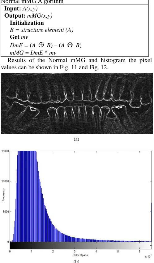 Fig. 11 Normal mMG algorithm with all teeth (a) result image, (b) histogram  