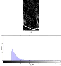 Fig. 14 Enhancement mMG algorithm with one tooth (a) result image, (b) histogram  