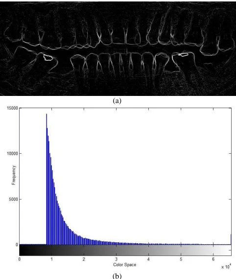 Fig. 15 Smooth mMG Algorithm with all teeth (a) result image, (b)  histogram  