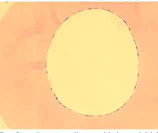 Figure 5 Cross-section of human umbilical vein endothelial cells (HUVECs) seeded on the inside of the fiber.