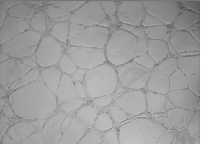 Figure 1.  Tube formation of HUVEC plated at 50,000 cells per  well of a Matrigel ®  coated, 48-well plate in Lonza EGM™-2  Medium after 16 hours in culture at 5X magnification