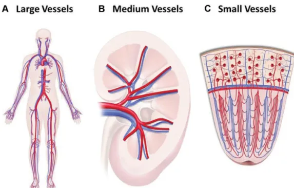 Figure 1. Types of vessels that are defined as large vessels (A), medium vessels (B), and small vessels (C) in the Chapel Hill Consensus Conference nomenclature system