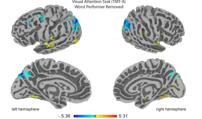 Figure S9 Cerebrum surface visualization of Correlation between centrality and time needed  in visual attention task (compare to Figure 2c) after removing the slowest subject in this task  (Figure S6)