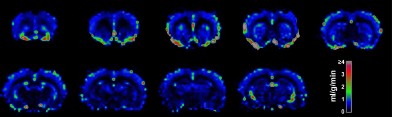 Figure 6 – Arterial Spin Labeling (ASL) of a rat brain after 14 consecutive days of 30mg/kg cocaine
