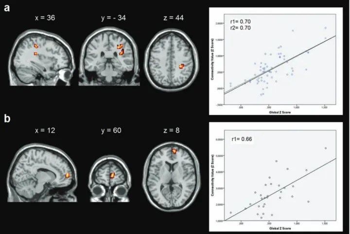 Figure 2.  Correlations between resting-state functional connectivity (rs-FC) and global cognitive Z scores