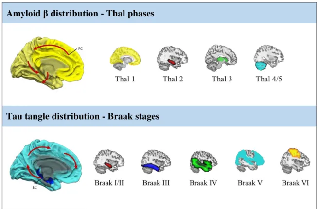 Figure  5  – The stereotypical distribution pattern of amyloid and tau pathology in Alzheimer’s disease