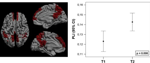 Fig. 2. The default mode network, marked red in the left frame, showed increased connectivity in the lower alpha band after resection