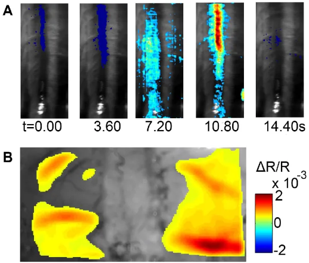 Figure  2-7:  (A)  Time  course  of  LOT  signals  evoked  by  left  hind  paw  stimulation  collected  at  detector 1 over 15s at 0.9× muscular threshold