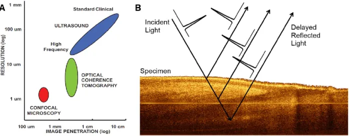 Figure  3-1:  (A)  OCT  resolution  compared  to  other  imaging  modalities.  Reproduced  from  (Drexler &amp; Fujimoto, 2008)