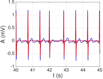Figure 9. Example of sparse ECG representation with the derived dictionary for a segment of signal121 from the PTB database