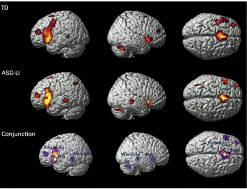 Fig. 2. A and B show the correlation matrices representing functional connectivity links among the eight identiﬁed language network regions evaluated in this study in TD (n = 19) (A) and ASD-LI patients (n = 13) (B)