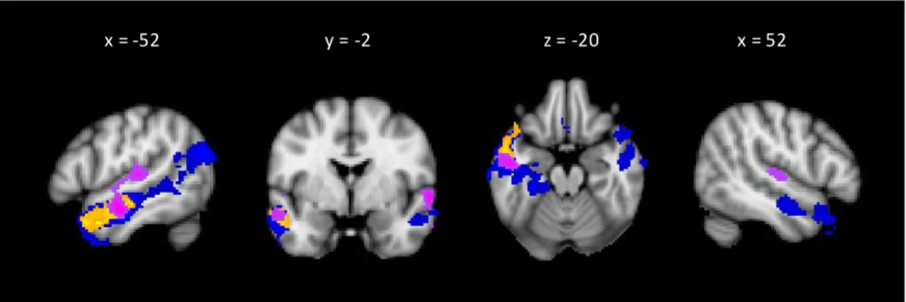 Figure 2. Groups activations for s emantic integration in listening (yellow), during syntactic integration in  listening (pink), and during semantic integration in reading (blue)