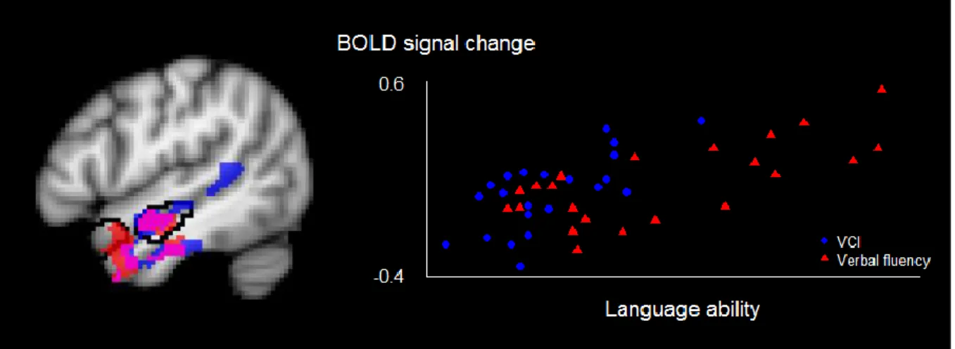 Figure 2. Correlations between language ability and BOLD responses to auditory sentence processing